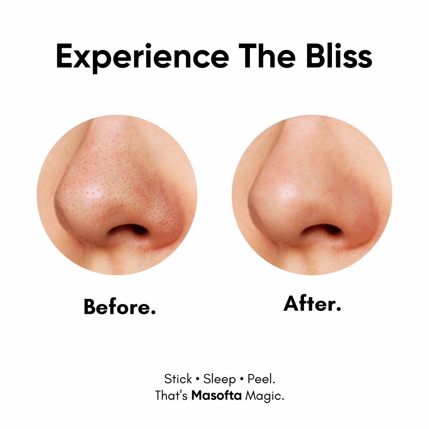 Masofta Pull Patch Nose with Hydrocolloid | Oil, Gunk & Impurity Removal | 3 Pcs