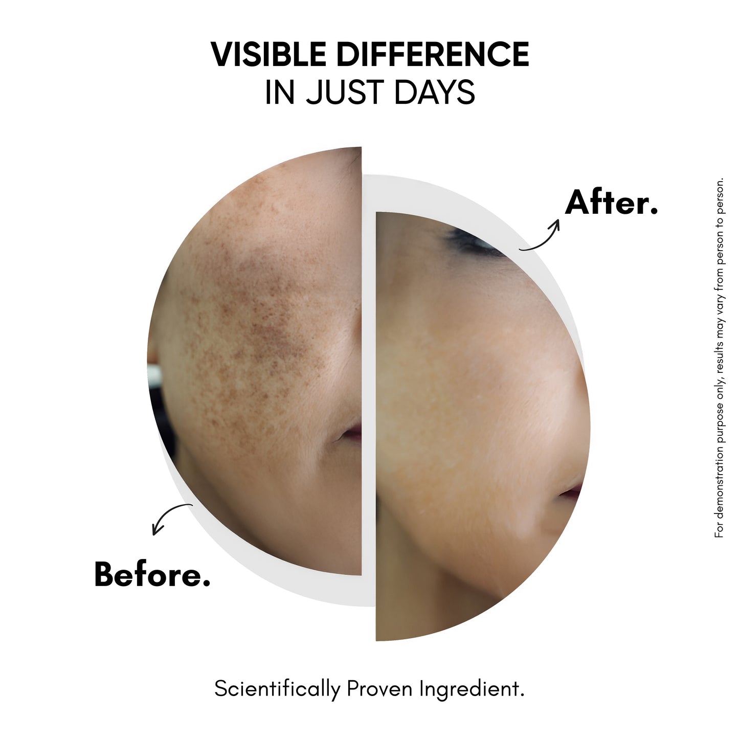 Masofta 2% Kojic Acid Soap | Dark Spot & Pigmentation Care
