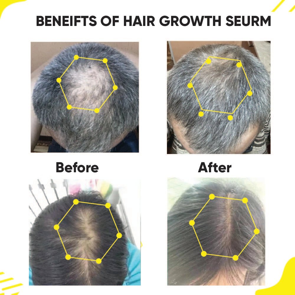 Masofta Hair Growth Serum Benefits