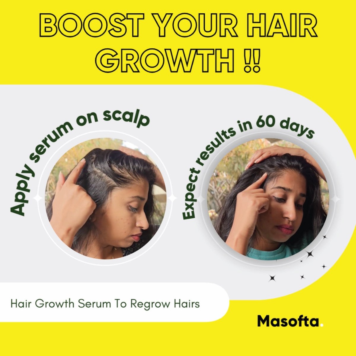 Masofta Hair Growth Serum Boosts Your Hair Growth