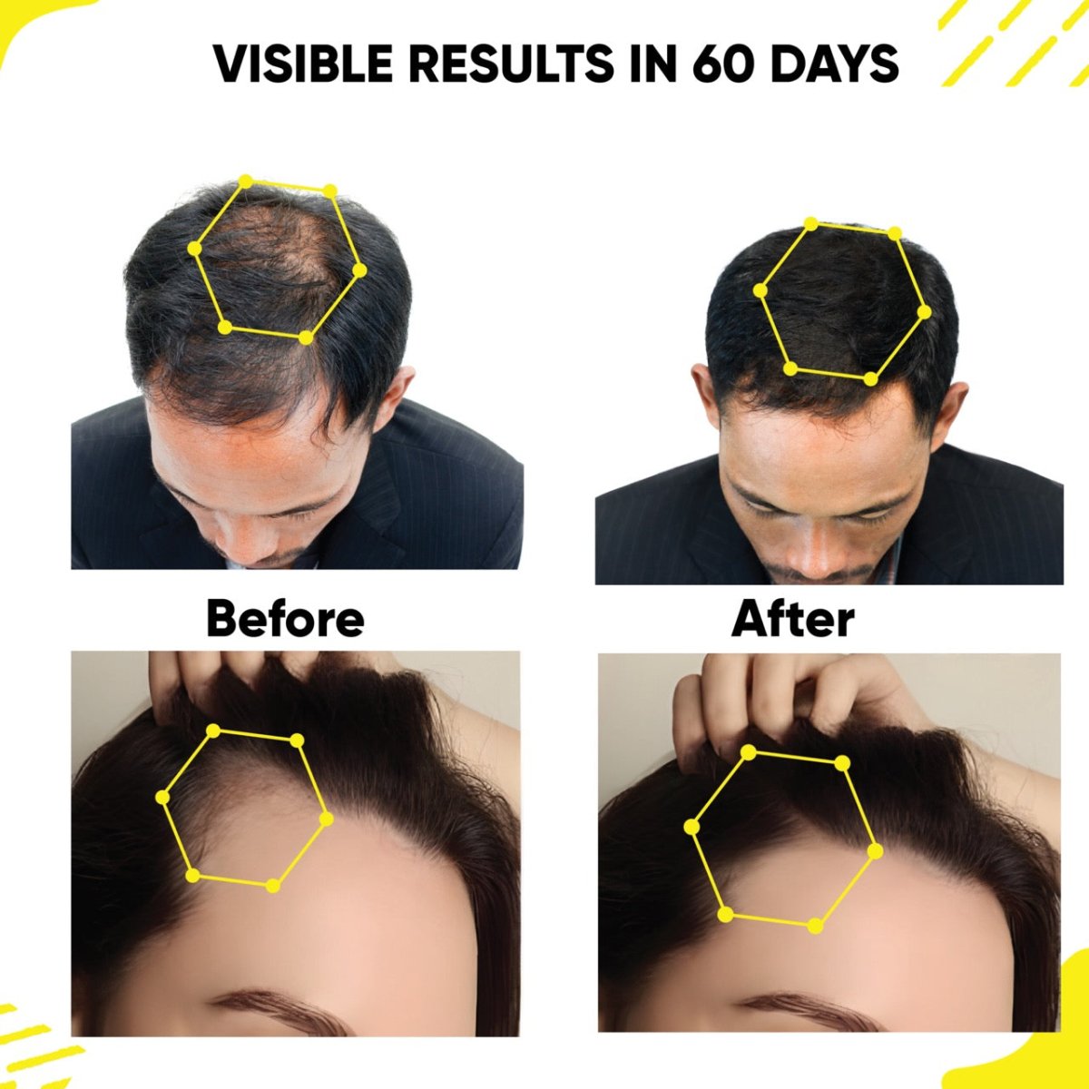 Masofta Hair Growth Serum Results