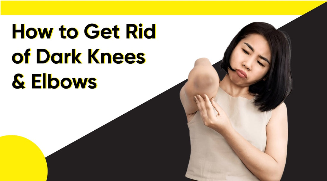 How to Get Rid Of Dark Knees And Elbows