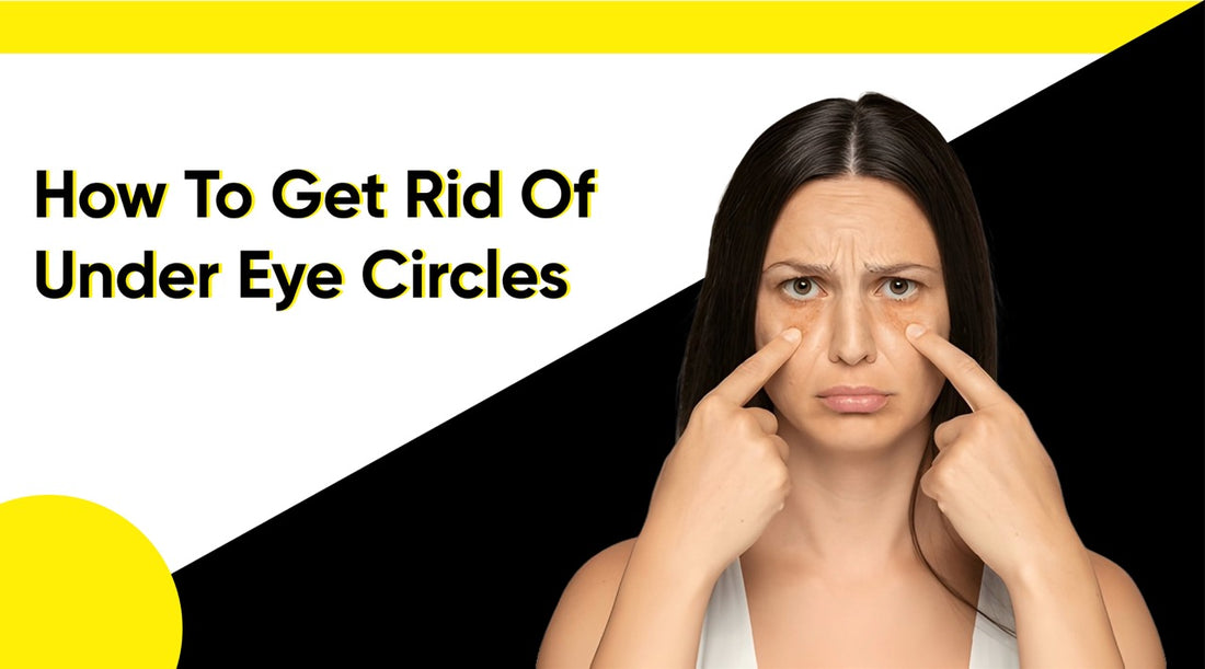 How to Get Rid of Under Eye Circles