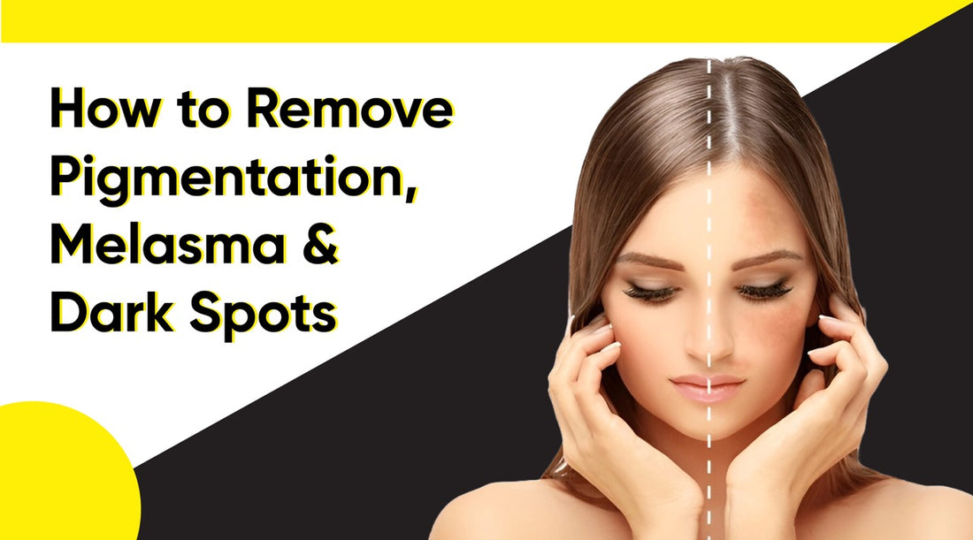How To Remove Pigmentation, Melasma & Dark Spots