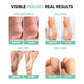 Masofta Exfoliating Foot Peel Mask – Removes Dead Skin & Calluses for Soft Feet