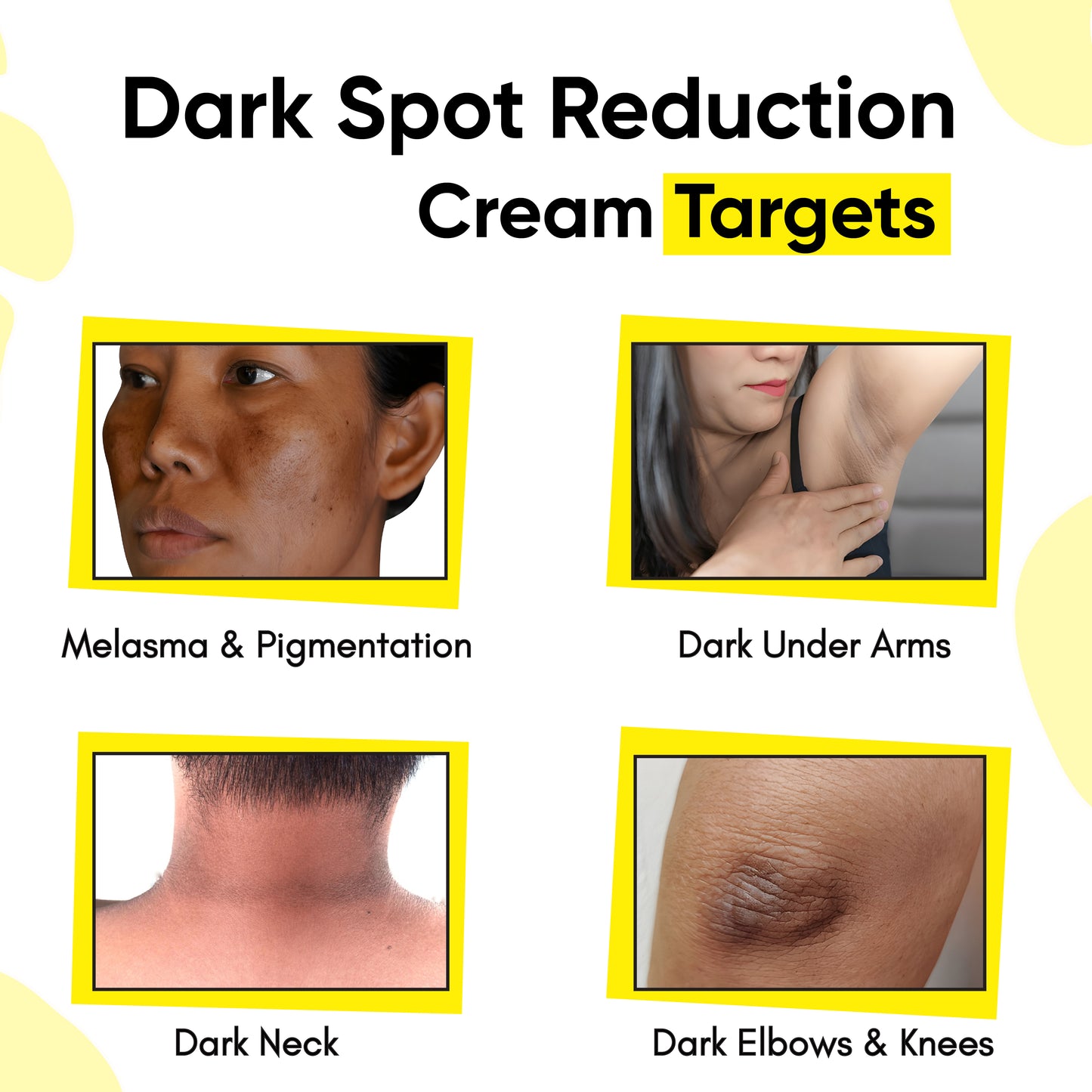 Dark spot reduction cream targets