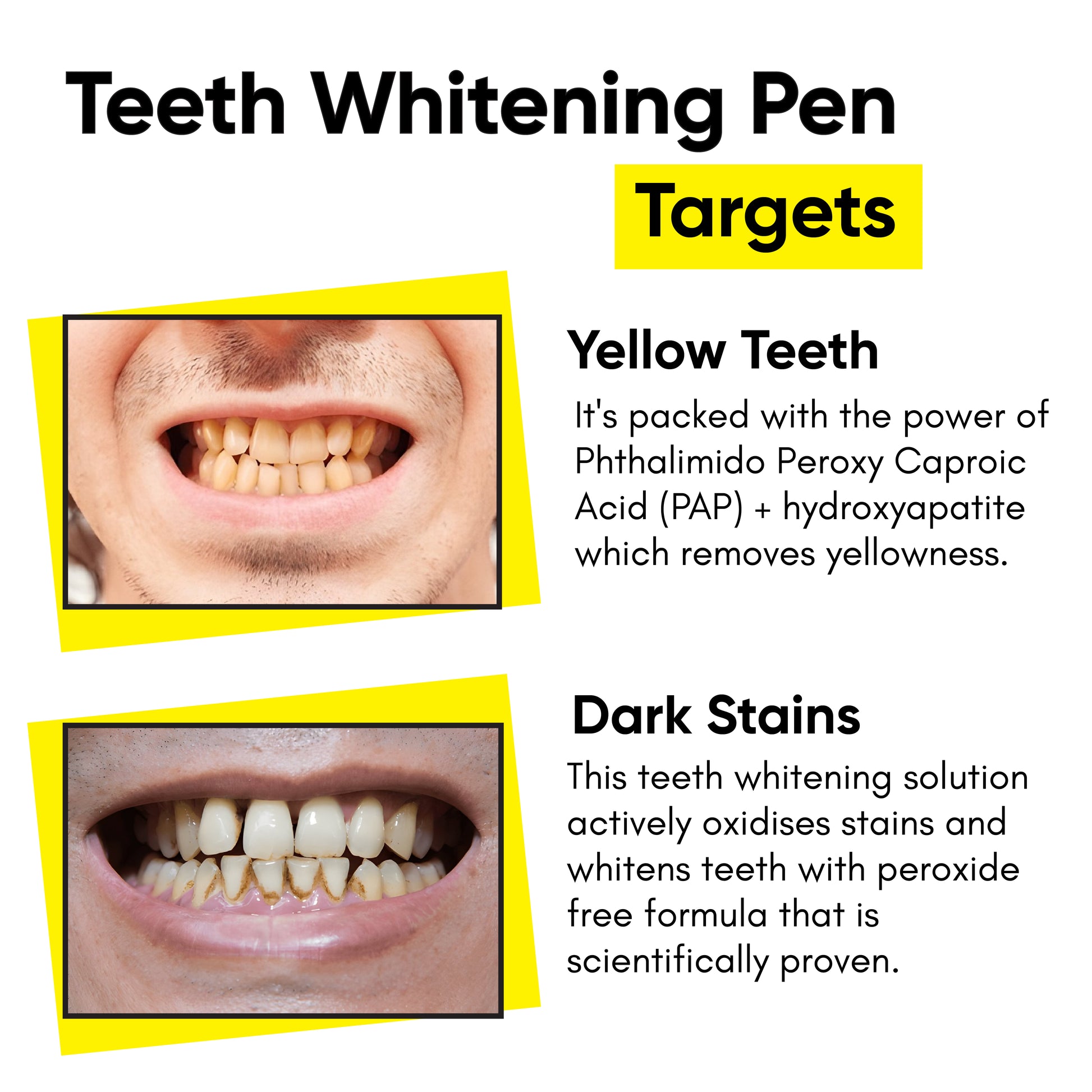 Masofta Teeth Whitening Pen Targets