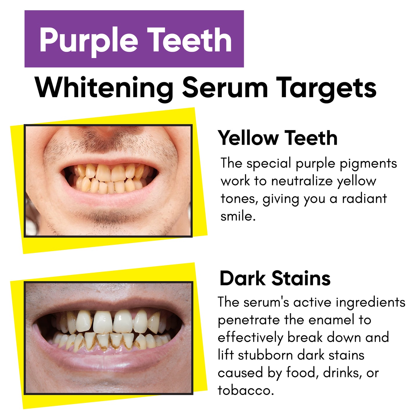 Teeth Whitening Serum Targets