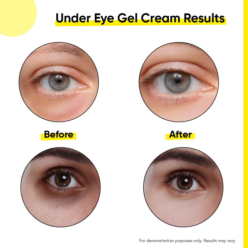 Masofta Under Eye Gel Cream Before After Results