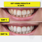 Teeth Whitening Strips